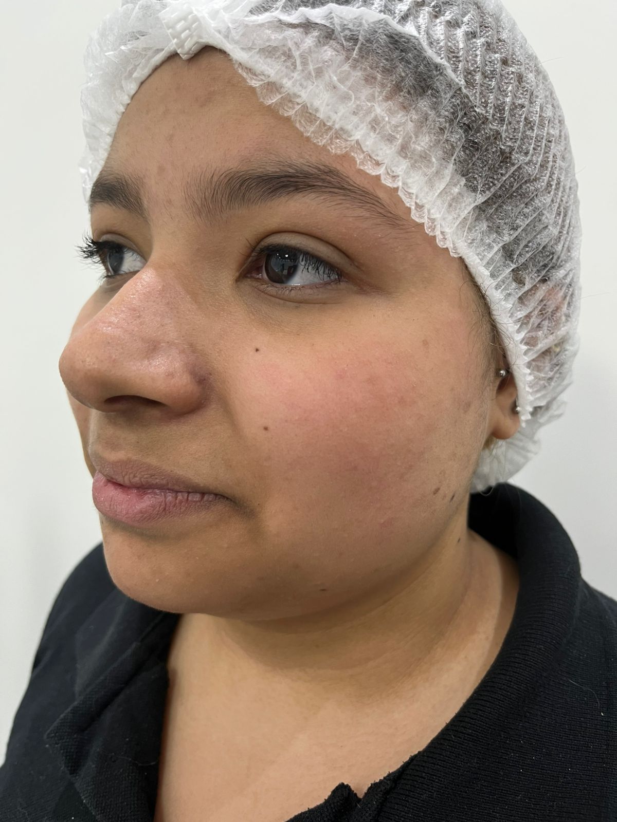 Resultado de procedimento 1